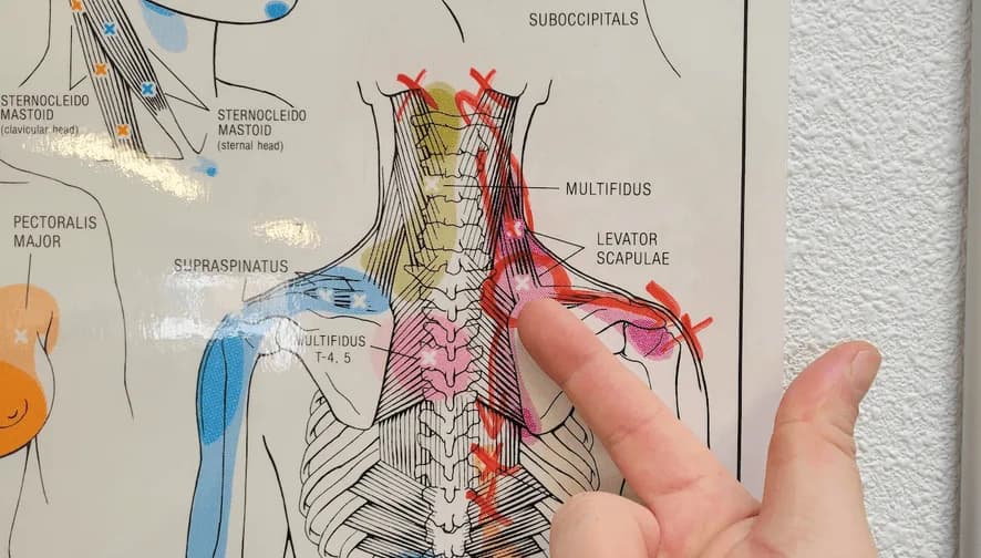Levator Scapulae Anatomy Diagram